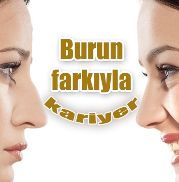 brun