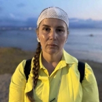 Denizde yüzerken jet ski çarptı, ölümden döndü