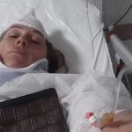 Denizde yüzerken jet ski çarptı, ölümden döndü