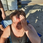 Denizde yüzerken jet ski çarptı, ölümden döndü